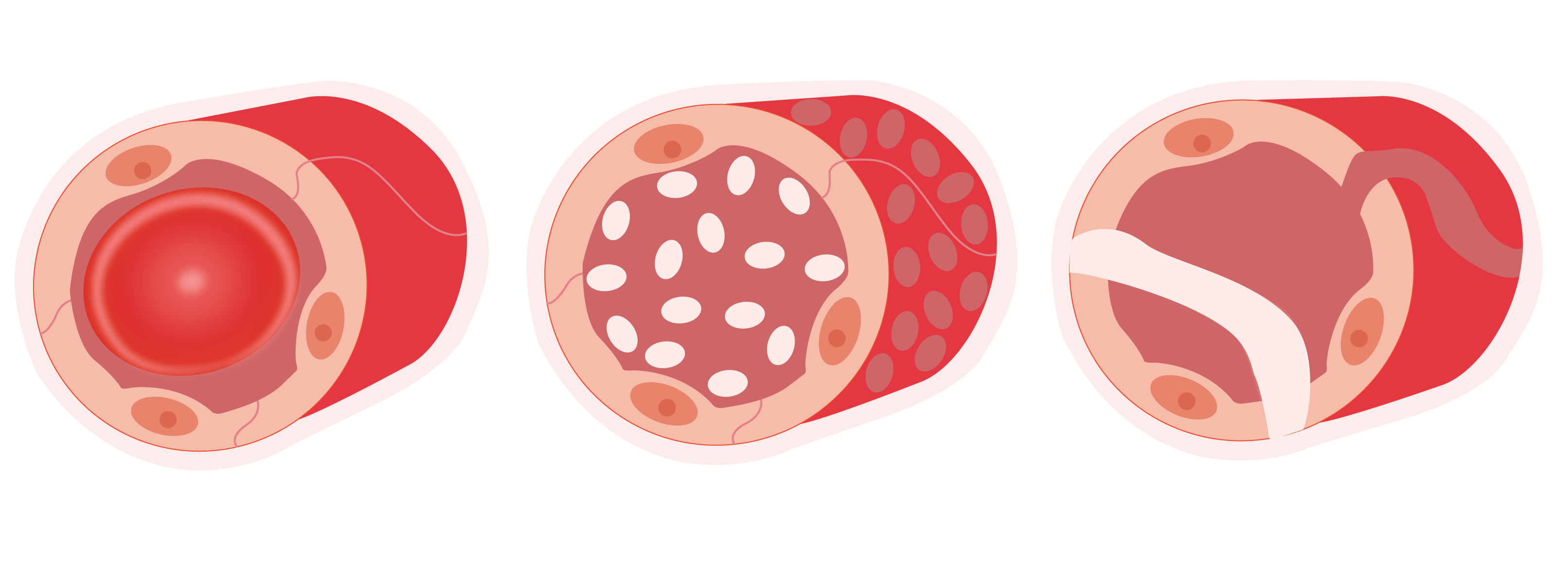 Human Capillary System